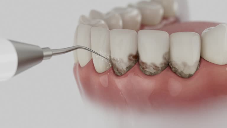 Reliable Dental contractor in Aspen Hill, MD by Dentist Open Now